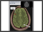 Click to enlarge: Brain Slice 1