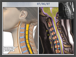 Click to enlarge: Neck