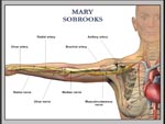 Click to enlarge: Arm Artery and Nerves